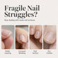 🧄💅 Odżywczy lakier do paznokci z czosnkiem – wzmacnia łamliwe i zniszczone paznokcie 💪✨ Pojemność: 15 ml
